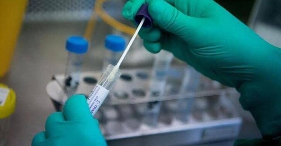 COVİD-19 PCR TESTİ YAPAN CİHAZ, SİİRT EĞİTİM VE ARAŞTIRMA HASTANESİ’NE GELDİ