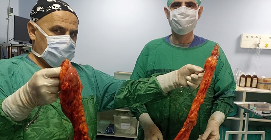 Doç. Dr. Akın Önder’den Başarılı Kolon Kanseri Ameliyatı: 64 Yaşındaki Hasta Sağlığına Kavuştu