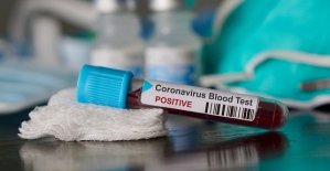 Corona Virüsle Mücadele Kapsamında Test Yapılacak Labaratuvar Sayısı 16'ya Çıkarıldı
