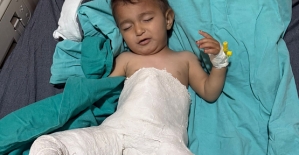 Minik Bebek, Başarılı Kalça Çıkığı Ameliyatı ile Sağlığına Kavuştu